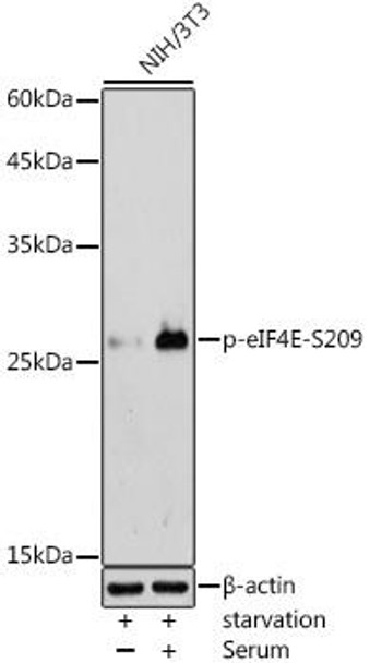Anti-Phospho-eIF4E-S209 Antibody (CABP0747)