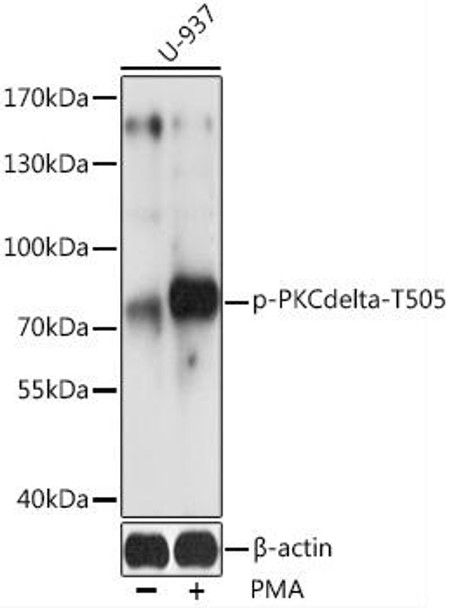 Anti-Phospho-PRKCD-T505 pAb Antibody (CABP0776)