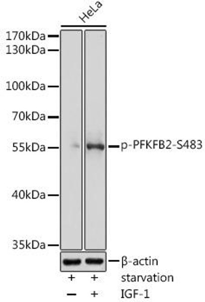 Anti-Phospho-PFKFB2-S483 pAb Antibody (CABP0784)