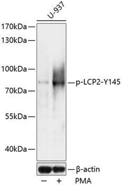 Anti-Phospho-LCP2-Y145 pAb Antibody (CABP0816)