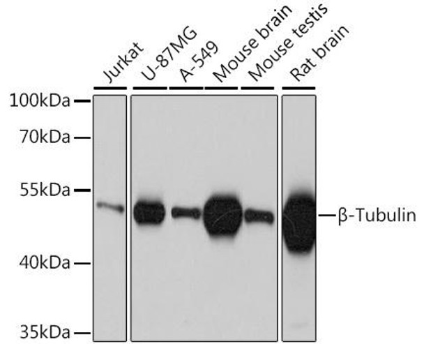 Anti-Beta-Tubulin Mouse Monoclonal Antibody (CABC010)