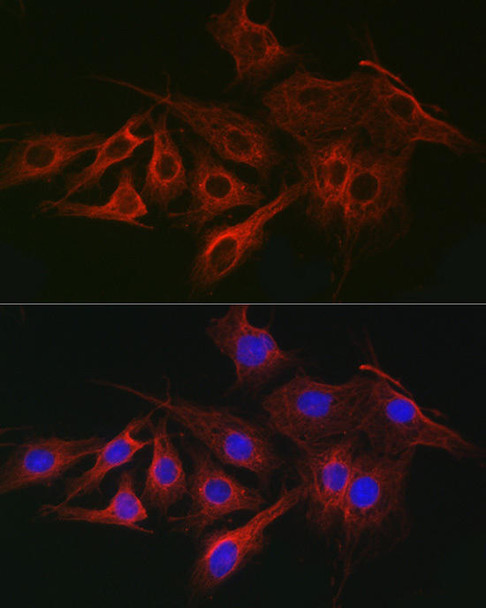 Anti-Alpha-Tubulin Mouse Monoclonal Antibody (CABC012)