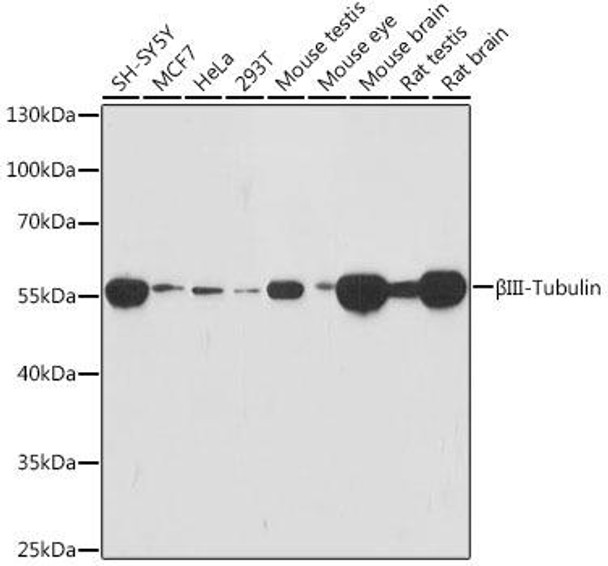 Anti-BetaIII-Tubulin Mouse Monoclonal Antibody (CAB18132)