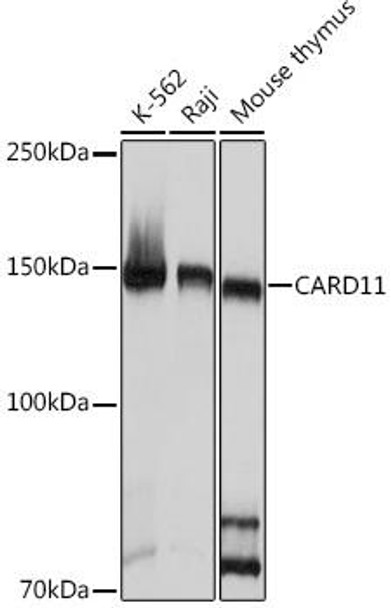 Anti-CARD11 Antibody (CAB9652)