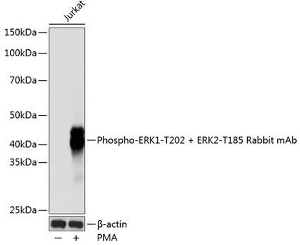 Anti-Phospho-ERK1-T202 + ERK2-T185 Antibody (CABP0485)