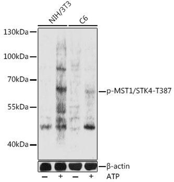 Anti-Phospho-MST1/STK4-T387 Antibody (CABP0906)