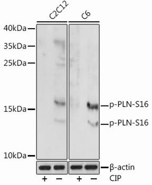 Anti-Phospho-PLN-S16 Antibody (CABP0907)