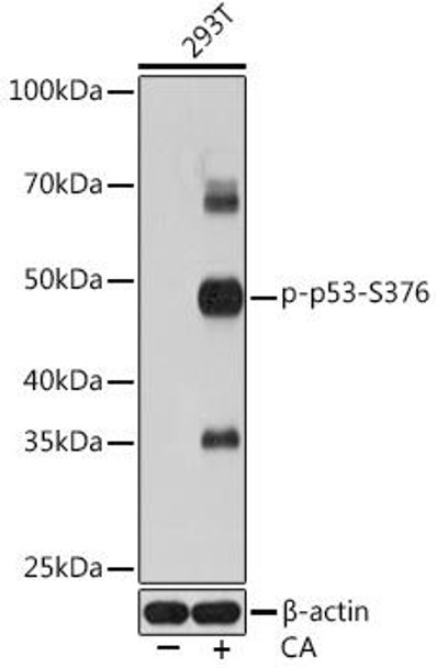 Anti-Phospho-p53-S376 Antibody (CABP0987)