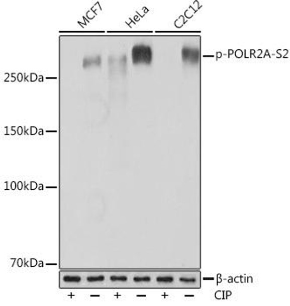 Anti-Phospho-POLR2A-S2 Antibody (CABP0996)