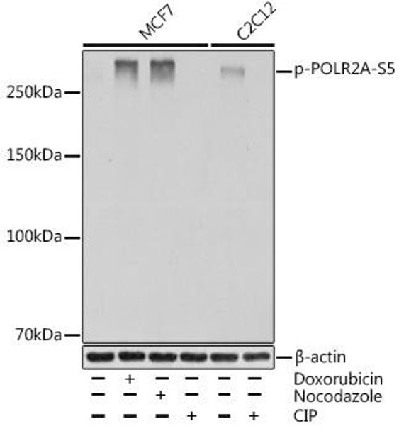 Anti-Phospho-POLR2A-S5 Antibody (CABP0997)