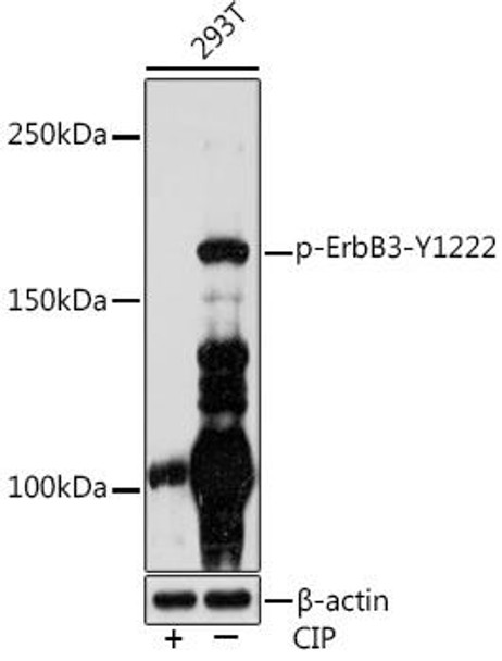 Anti-Phospho-ErbB3-Y1222 Antibody (CABP1052)