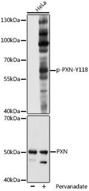 Anti-Phospho-PXN-Y118 Antibody (CABP1057)