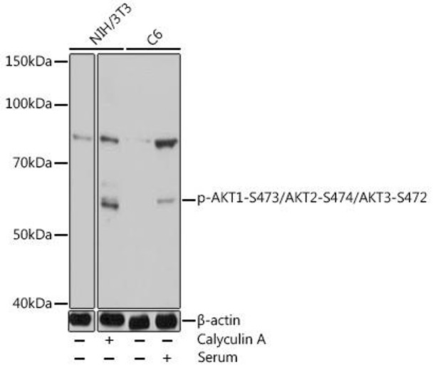 Anti-Phospho-AKT1-S473+AKT2-S474+AKT3-S472 Antibody (CABP1068)