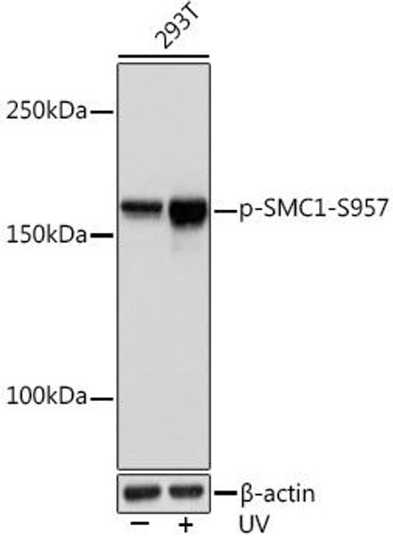 Anti-Phospho-SMC1-S957 Antibody (CABP1145)