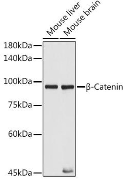 Anti-beta-Catenin [KO Validated] Antibody (CAB20221)