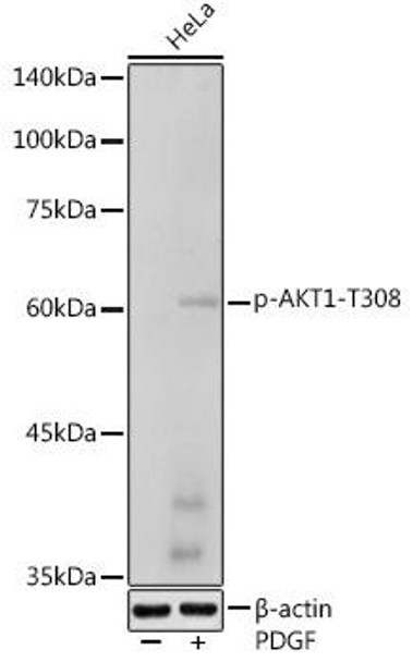 Anti-Phospho-AKT1-T308 Antibody (CABP1214)