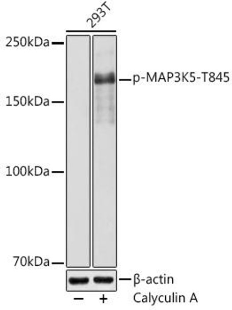Anti-Phospho-MAP3K5-T845 Antibody (CABP1215)