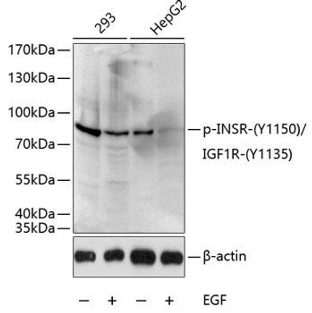 Anti-Insulin receptor Antibody (CABP0044)