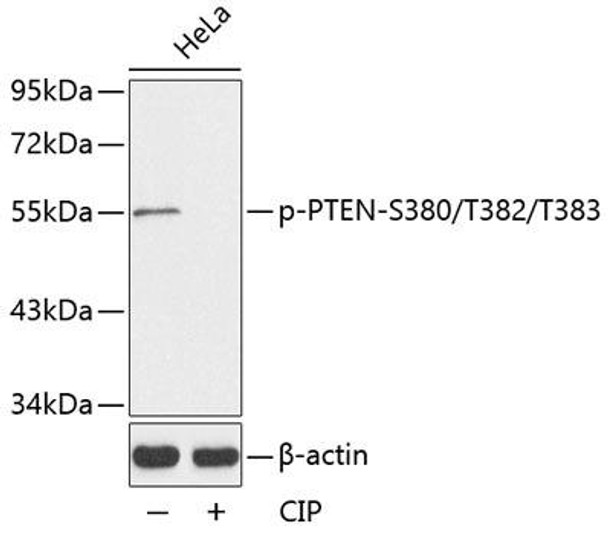 Anti-Phospho-PTEN-S380/T382/T383 Antibody (CABP0141)