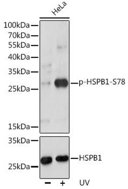 Anti-Phospho-HSPB1-S78 Antibody (CABP0236)