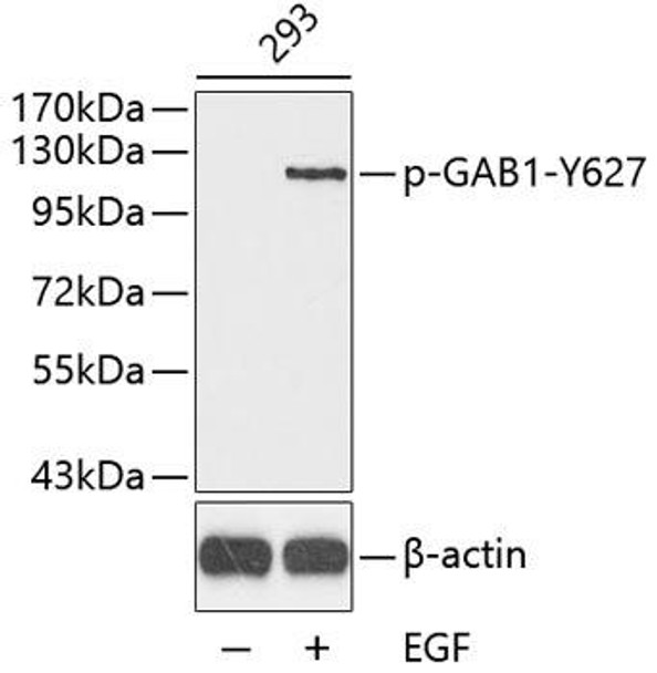 Anti-Phospho-GAB1-Y627 Antibody (CABP0256)