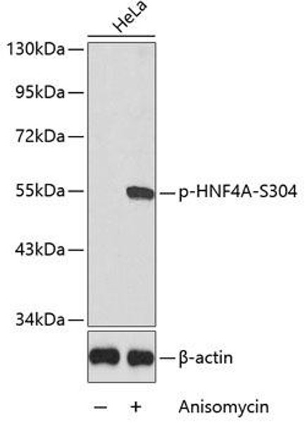 Anti-Phospho-HNF4A-S304 Antibody (CABP0362)