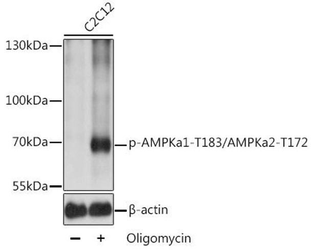 Anti-Phospho-PRKAA1-T183/PRKAA2-T172 Antibody (CABP0432)