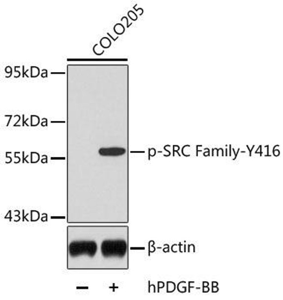 Anti-Phospho-SRC-Y416 Antibody (CABP0452)