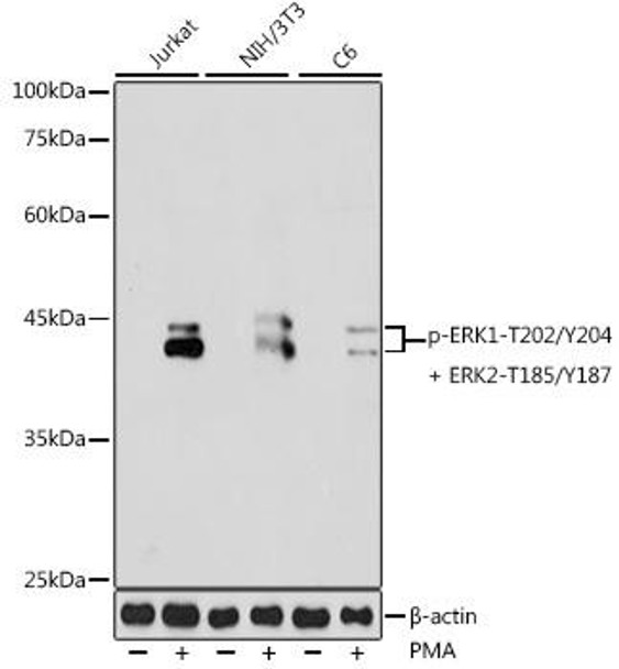 Anti-Phospho-ERK1-T202/Y204 + ERK2-T185/Y187 Antibody (CABP0472)