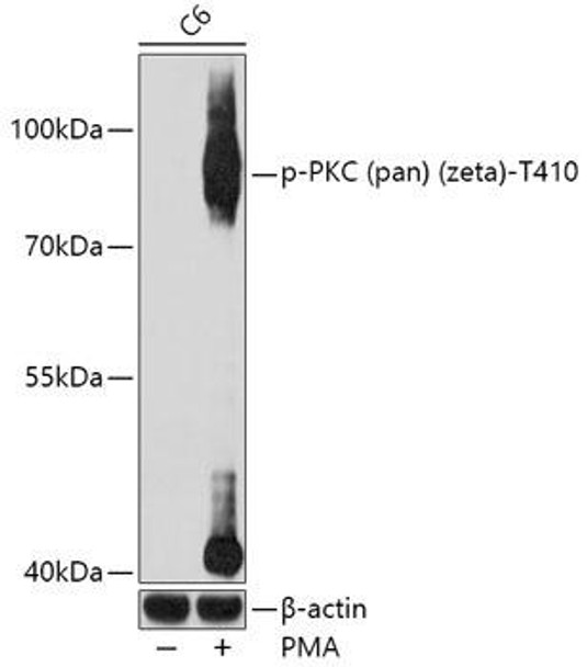 Anti-Phospho-PKC (pan) (zeta)-T410 Antibody (CABP0520)