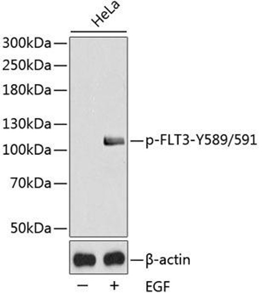 Anti-Phospho-FLT3-Y589/591 Antibody (CABP0529)