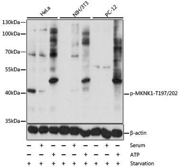 Anti-Phospho-MKNK1-T197/202 Antibody (CABP0544)