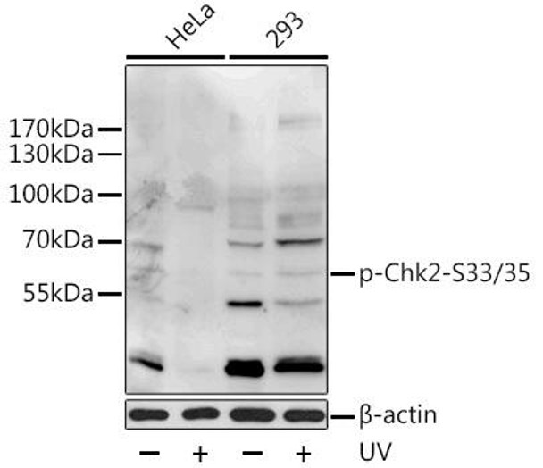 Anti-Phospho-CHEK2-S33/35 Antibody (CABP0545)