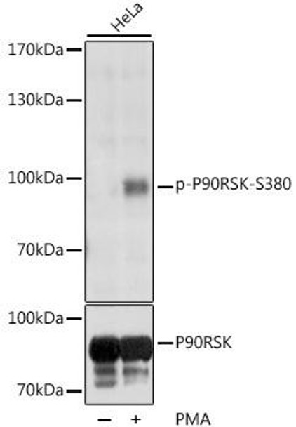 Anti-Phospho-P90RSK-S380 Antibody (CABP0562)