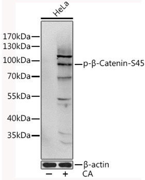 Anti-Phospho-CTNNB1-S45 Antibody (CABP0580)