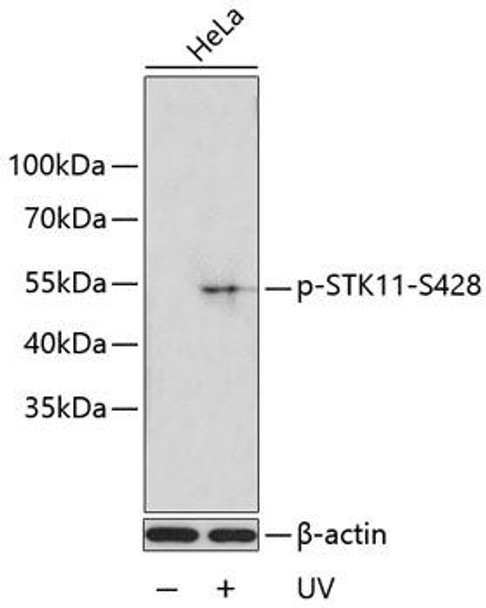 Anti-Phospho-STK11-S428 Antibody (CABP0602)