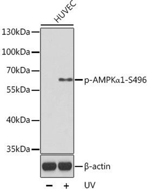 Anti-Phospho-PRKAA1-S496 Antibody (CABP0619)