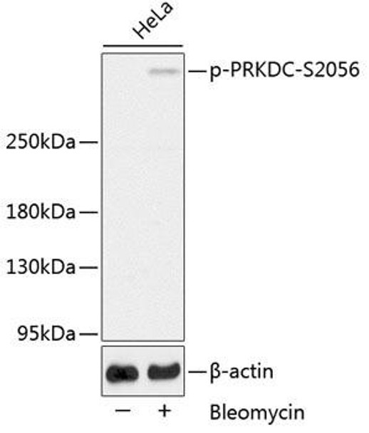 Anti-Phospho-PRKDC-S2056 Antibody (CABP0621)