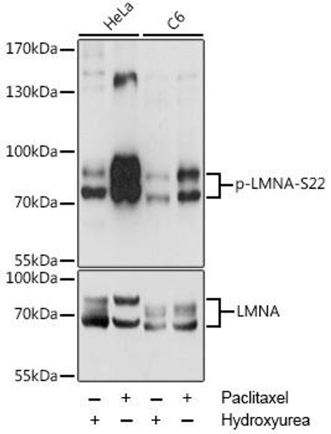 Anti-Phospho-LMNA-S22 pAb Antibody (CABP0777)