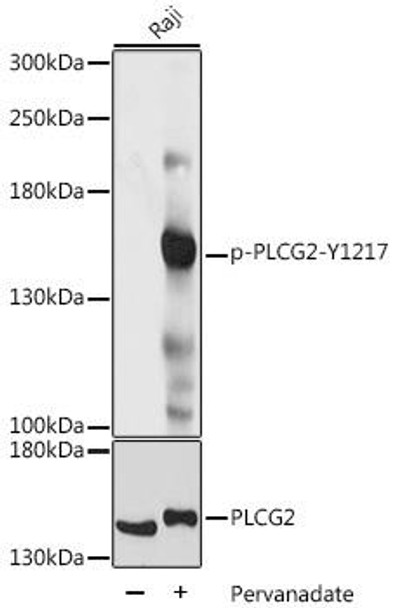 Anti-Phospho-PLCG2-Y1217 pAb Antibody (CABP0805)
