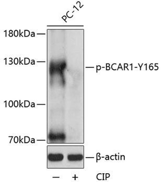 Anti-Phospho-BCAR1-Y165 pAb Antibody (CABP0813)