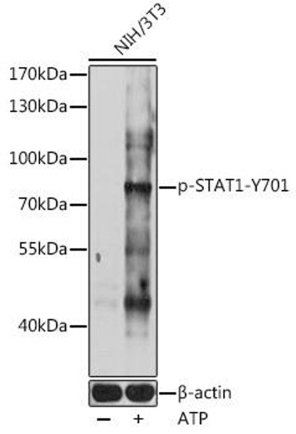 Anti-Phospho-STAT1-Y701 pAb Antibody (CABP0858)