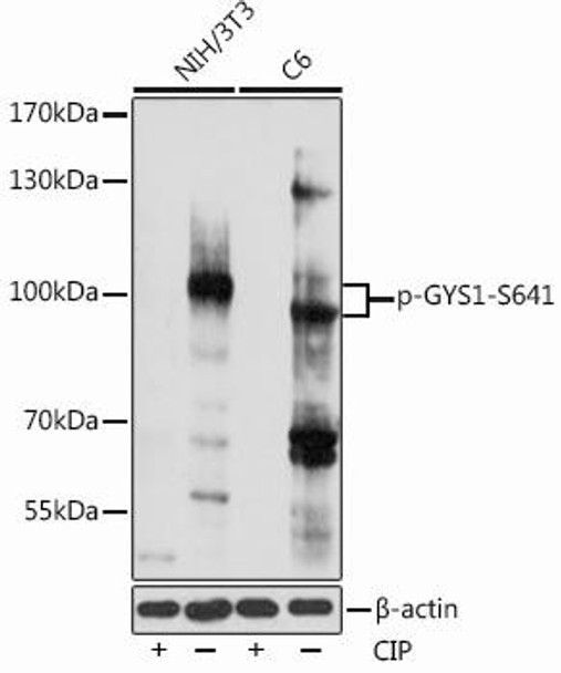 Anti-Phospho-GYS1-S641 pAb Antibody (CABP0877)