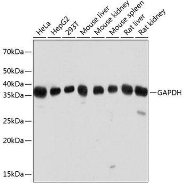 Anti-GAPDH Antibody (High Dilution) (CABC033)