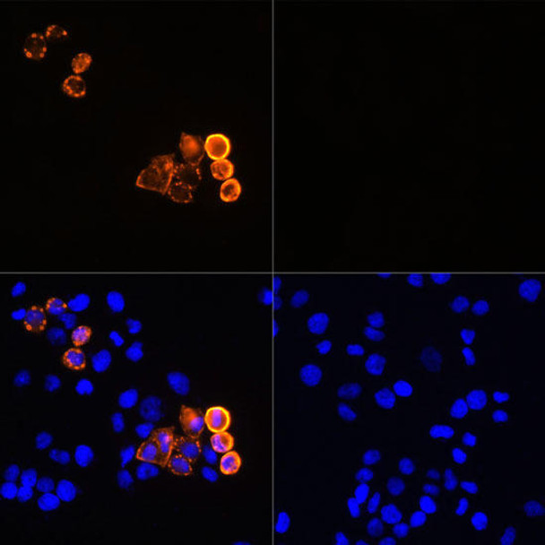 Anti-Myc-Tag Antibody (CABE070)