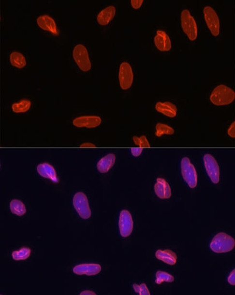 Anti-Alexa Fluor 594-conjugated AffiniPure Goat Anti-Rabbit IgG (H+L) Antibody (CABS074)