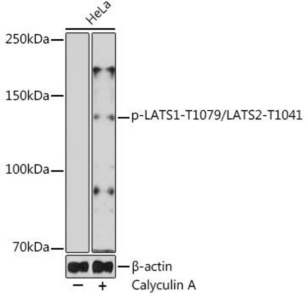 Anti-phospho-LATS1-T1079/LATS2-T1041 Antibody (CABP0912)