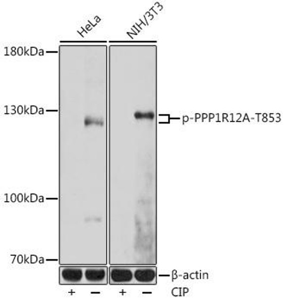 Anti-Phospho-PPP1R12A-T853 Antibody (CABP0916)