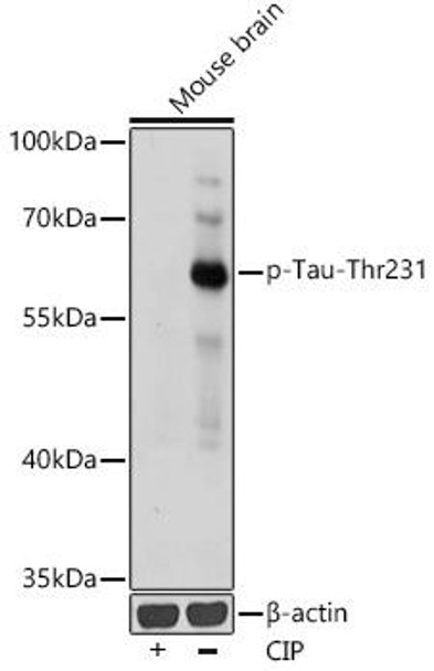 Anti-Phospho-Tau-Thr231 Antibody (CABP0923)