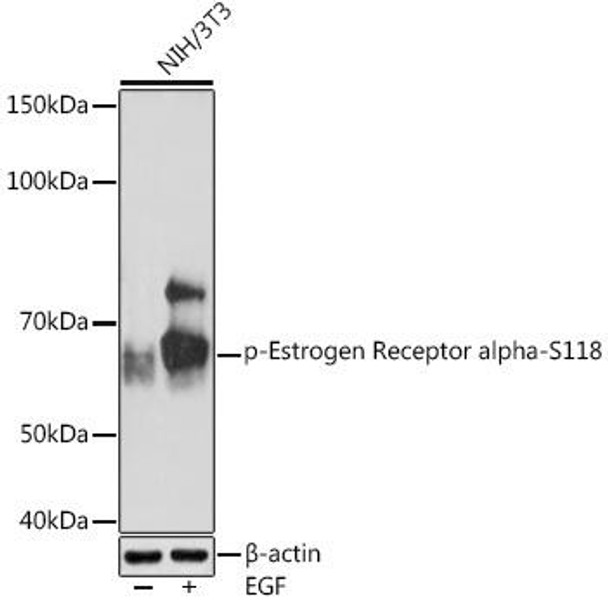 Anti-Phospho-Estrogen Receptor alpha-S118 Antibody (CABP1004)